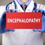 Берут ли в армию с энцефалопатией: серьезное заболевание как препятствие для несения воинской службы
