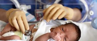 cerebral ischemia grade 2 in newborns treatment