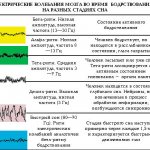 Электрические ритмы головного мозга