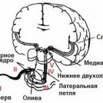 issledovanie vizvannix potentsialov 8AB2 - Исследование вызванных потенциалов головного мозга
