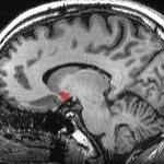 red spot in the brain