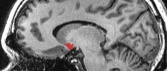 red spot in the brain