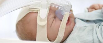 Treatment of apnea in infants using a CPAP machine