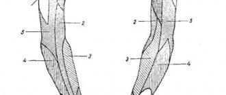 Nerves arising from the brachial plexus