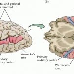 Areas of the superior temporal gyrus responsible for the perception of spoken language
