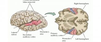 Areas of the superior temporal gyrus responsible for the perception of spoken language