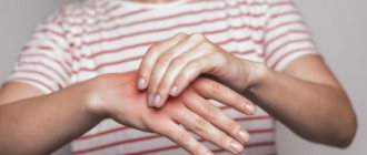 Numbness of fingers and hands after heavy drinking - Verimed