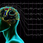 Расшифровка показателей ЭЭГ головного мозга