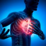 Severe tachycardia - Cordiyamed