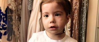 Синдром Мебиуса – какие врачи способны помочь ребенку?