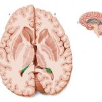 Choroid plexuses of the brain