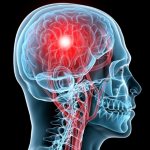 how to recognize a concussion and what to do