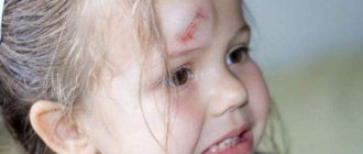 Girl&#39;s head injury
