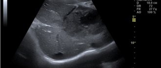 Ultrasound of the child&#39;s abdomen