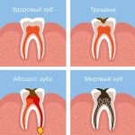 The occurrence of periostitis and its consequences in pictures